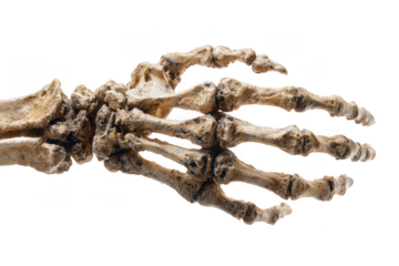 A detailed image of a human hand skeleton showing the bones from the wrist to the fingertips, positioned palm down.