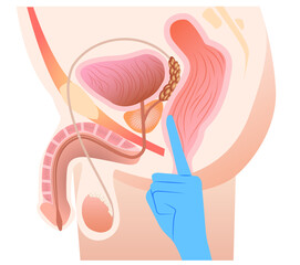 Prostate massage
