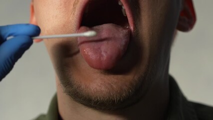 A patient's mouth is tested for disease and viruses in a laboratory.
Medical examinations and laboratory analysis.
A doctor wearing gloves collects a saliva sample for DNA testing. - Powered by Adobe