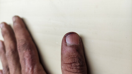 Close-up photo of a rough male hand with visible skin texture and dirt, symbolizing hard work,...