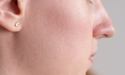 Profile photo of woman with natural skin, minimal makeup and a gold earring. Perfect for skincare, dermatology, facial analysis, beauty content, or medical concept visuals.