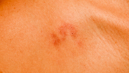 A reddish mark is visible on skin, resembling a pet's paw print. The imprint suggests playful interaction with an animal. Warm indoor lighting highlights the detail of the mark