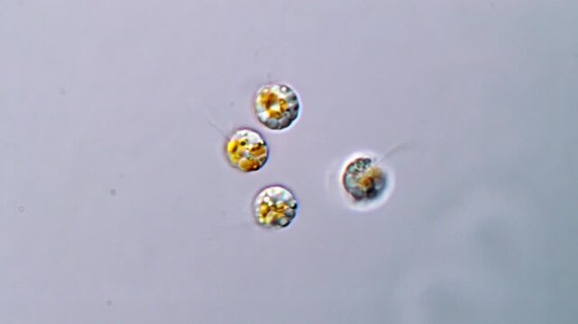 Movement of Microalgae under microscopic view, toxic algae 