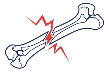 Cartoon illustration of a broken bone with red lightning bolts
