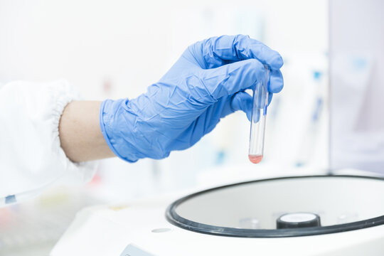 Scientist hand wear blue gloves holding glass blood test tube and reagent into the centrifuge for analysis blood group with blood cross matching for emergency patient at blood bank unit in laboratory.