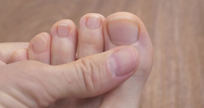 Self-massage of foot and toes. Man massages his foot and fingers. Acupressure. Beautiful male foot with uncut nails. Foot and toes of an adult man close-up shot, relax video