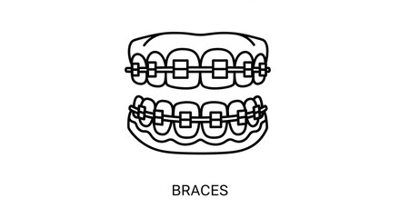 Dental Braces Illustration Isolated on White Background