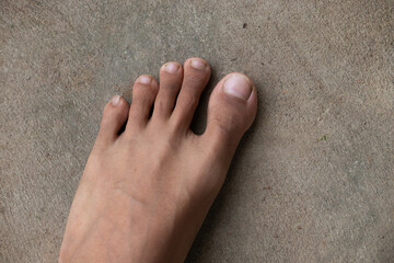 A top-down photo of a person's bare foot standing on a concrete floor.