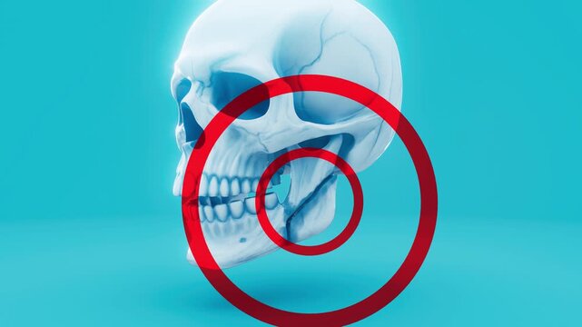 Conceptual 3D animation of a jaw fracture