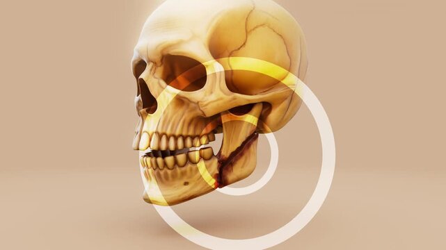 Conceptual 3D animation of a jaw fracture