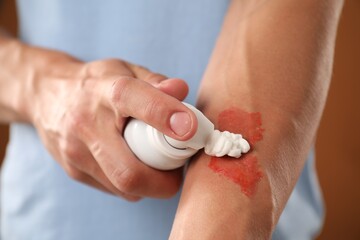 Man applying healing cream onto burned hand on brown background, closeup
