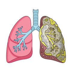 Anatomical Illustration of Human Lungs and Respiratory System