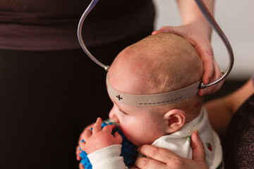 Physio performing Cranial Shape Measurement assessment Using a Caliper tool and Elastic Band
