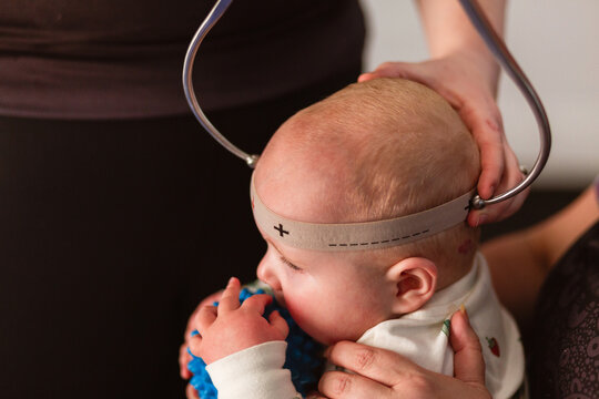 Physio performing Cranial Shape Measurement assessment Using a Caliper tool and Elastic Band