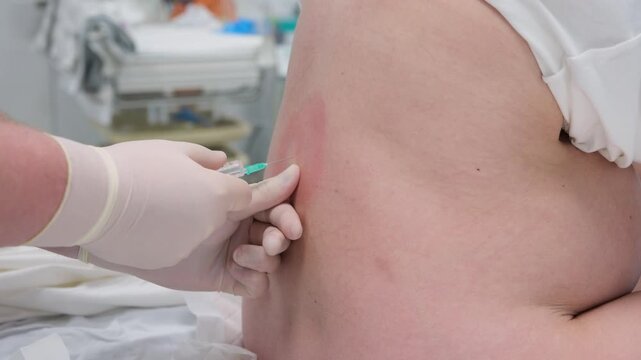 Healthcare professional gives an intramuscular injection of anesthesia into the back of a pregnant patient before administering an epidural.