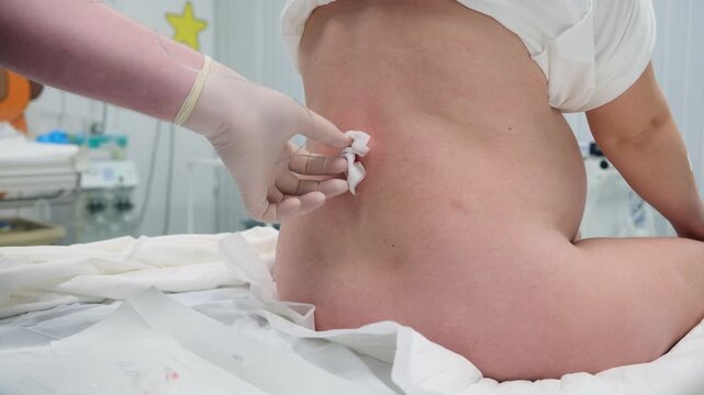 Medical professional carefully inserting epidural catheter into pregnant woman's lower back during labor, providing effective pain management in sterile hospital environment