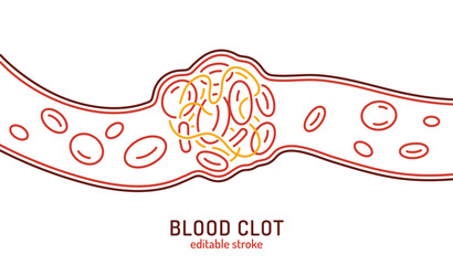 Blood Clot Background Vector illustration useful for presentations