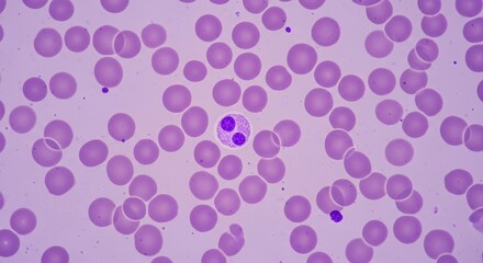 A microscopic view of human blood cells showcasing numerous red blood cells and a