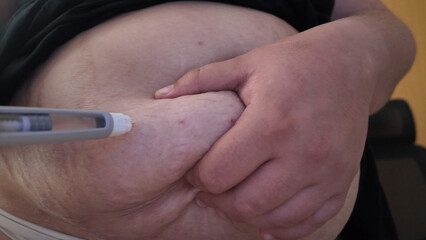 Close-up shot of an injection being administered into the abdomen, emphasizing skin pinching technique. Image highlights subcutaneous administration.