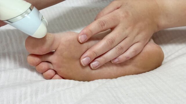 Person uses an electric callus remover on their foot on a bed in the morning for foot care