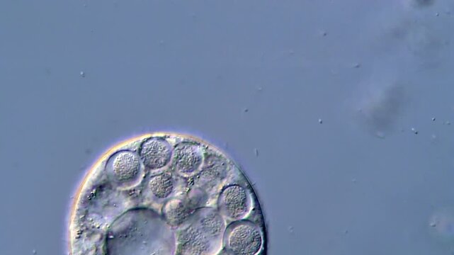 Single-Cell Protozoan Ciliates Observed in 4K