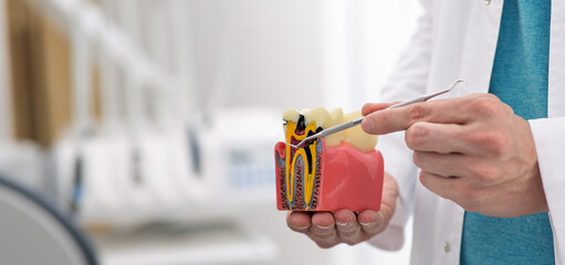 Dentist displays a tooth model to highlight its anatomy and the importance of dental care during a consultation. Caries treatment