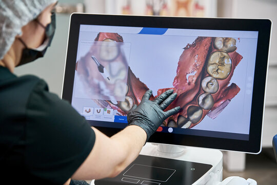 The doctor looks at picture of the teeth on the monitor