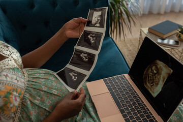Expecting Parent Reviewing Ultrasound Images While Relaxing at Home