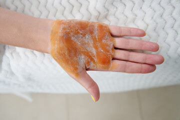 cosmetologist makes injections of botulinum toxin on the palms of a woman against hyperhidrosis. Female cosmetology, skin