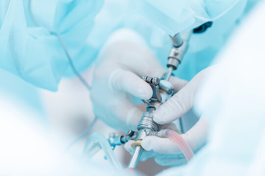 Laparoscopic surgery on prostate adenoma with medical instruments in operating room