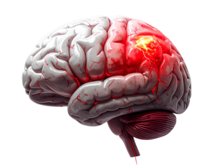  Human brain with red highlight indicating an issue on transparent background