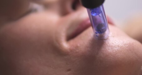 Cosmetic procedure microneedling. Facial skin care. A woman undergoes a procedure for restoring and regenerating facial skin. A cosmetologist works in a cosmetic office. - Powered by Adobe
