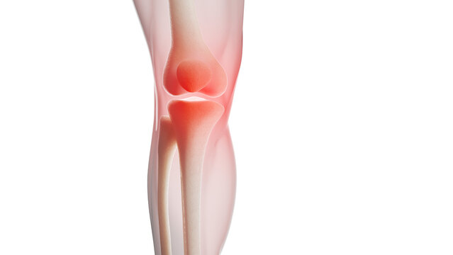 Knee pain, conceptual illustration