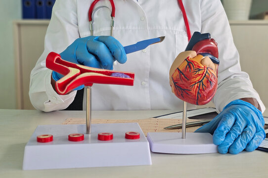 Cardiologist surgeon demonstrates models heart and blood vessel anatomy and scalpel. Heart surgery stenting coronary artery bypass graft