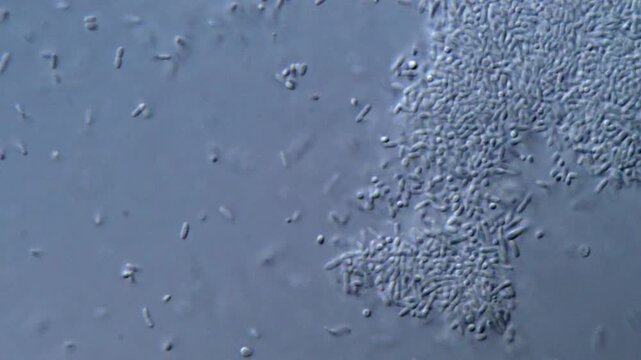 Bacteria under microscope showing motility behavior