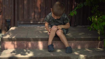 a little boy sits on the porch on a hot summer day in close up he touches his scraped knee with his finger wearing a t shirt and shorts
