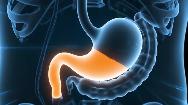 Digestive System Anatomy with Intestinal Inflammation, Acid Reflux, and Gastric Health Issues