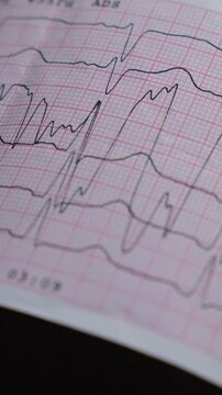 A paper ECG of a sick person's heart.
Study of the ECG and patient history.
Heart rhythm and heart disease.
Heart problems and tachycardia.
Heart, pain, heart attack, pulse