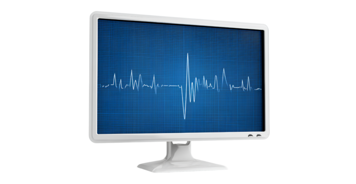 an image of a blue-colored individual monitor with a heart rate line graph on the screen, against a white background, in a transparent png format