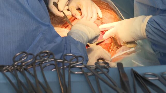 A close-up of a C-section delivery shows a medical team in sterile gowns and gloves carefully assisting the birth of a newborn baby.
