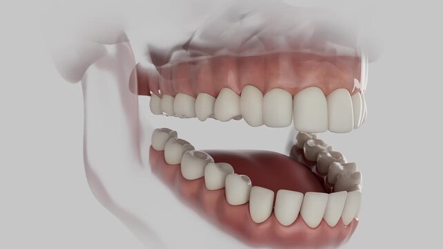 3D Dental Animation &mdash; Overjet Bite Correction with Clear Aligner