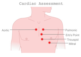 Cardiac assessment points. Areas for auscultation of heart valves. Aortic, pulmonary,  Erb's point, tricuspid.. Vector illustration