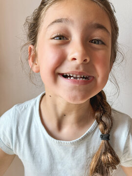 Child Smiling Happily With Missing Teeth in Bright Setting