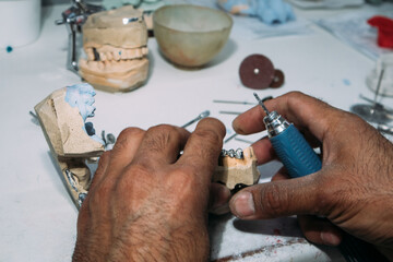 Dental technician adjusting metal bridge