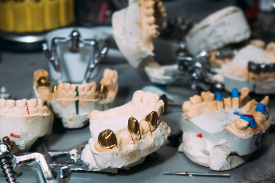 Dental prosthetic molds on workbench