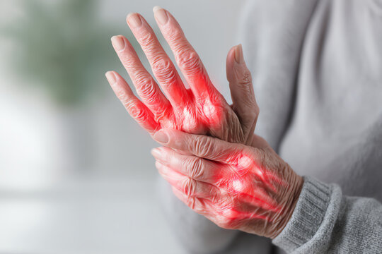 Elderly hands showing signs of arthritis pain, highlighted by red inflammation spots on fingers and knuckles, with one hand gently massaging the other