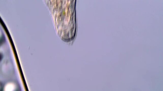 Freshwater flatworm head under microscope view 