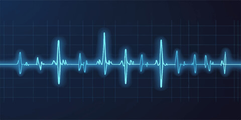 Blue electrocardiogram waves illustrate a continuous heartbeat on a medical monitor