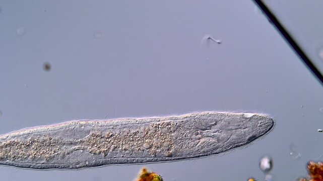 Movement of Flatworm under microscope 400x magnification 