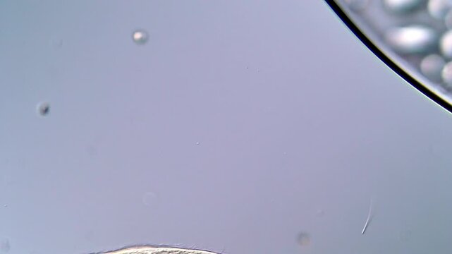 Stenostomum flatworm under microscope with unicellular organisms